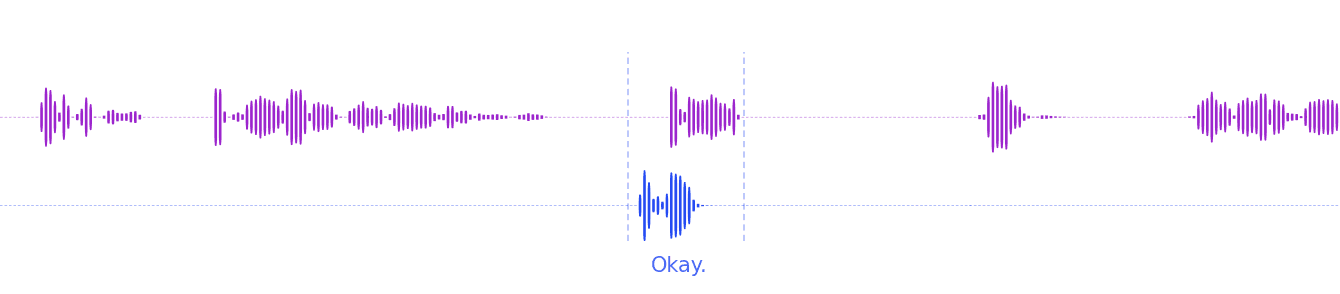 VAD-only detection light waveform